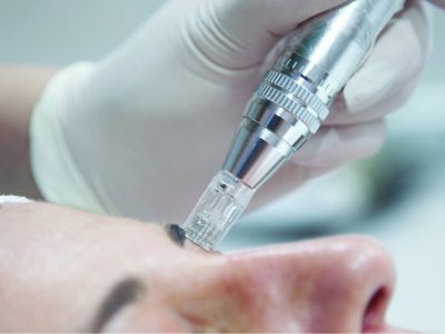 Germaine de Capuccini Dermatech pen tűs mezoterápia kezelőfej közelről