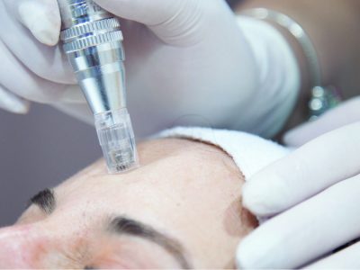 Germaine de Capuccini Dermatech pen tűs mezoterápia kezelőfej közelről